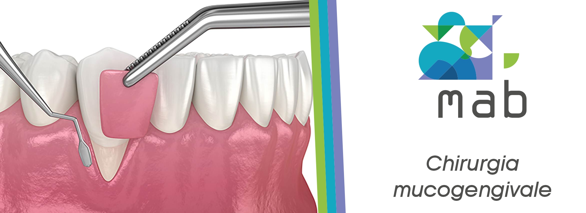 Chirurgia Gengivale Roma Tuscolana