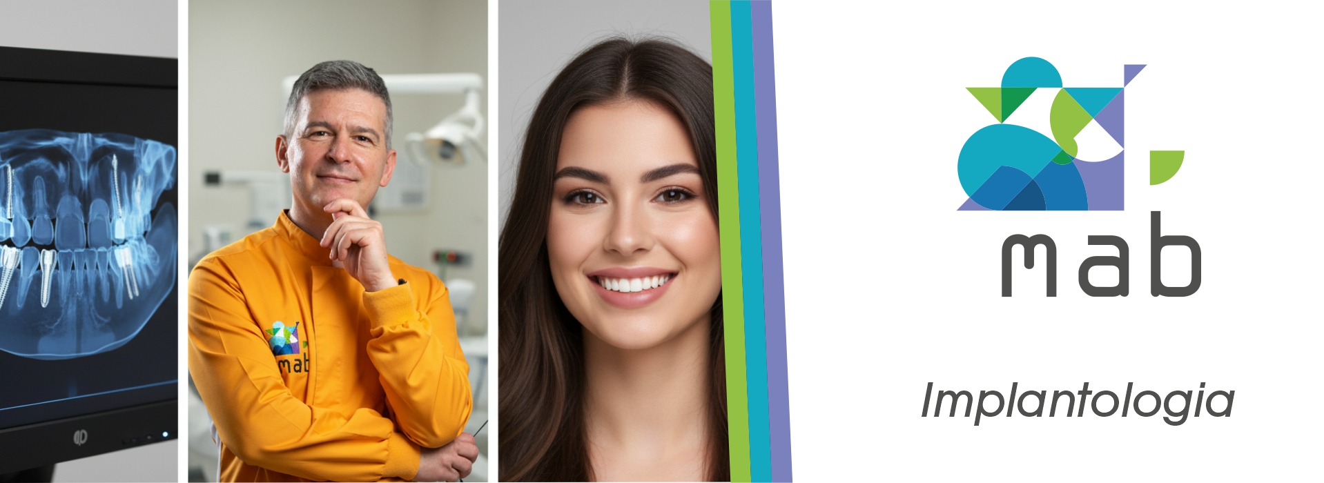 Implantologia Roma Tuscolana