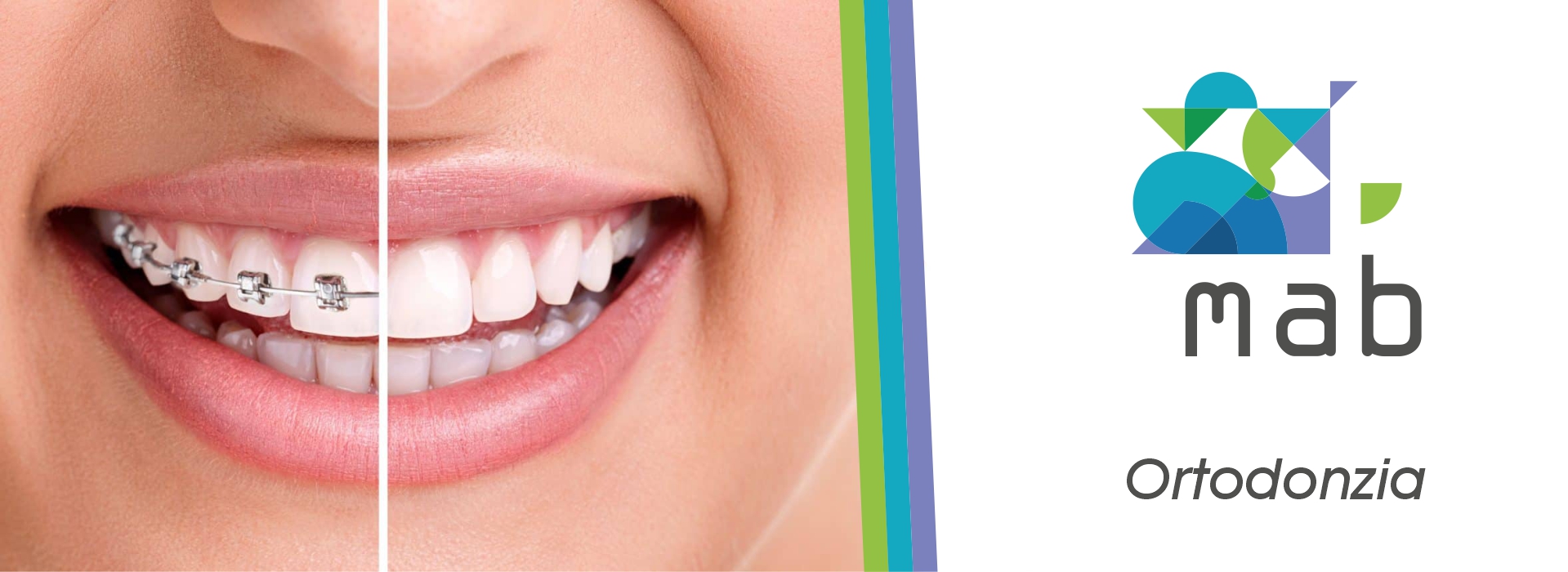 Ortodonzia Roma Tuscolana