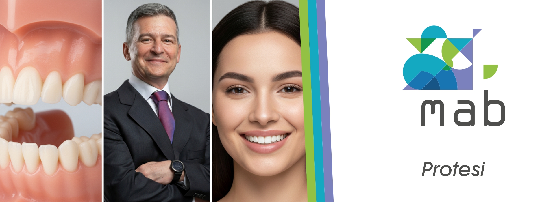 Protesi Dentale Roma Tuscolana