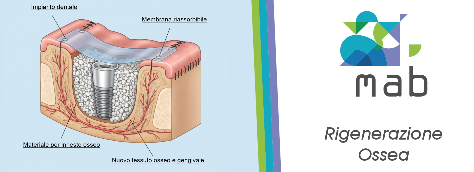 Rigenerazione Ossea Roma Tuscolana