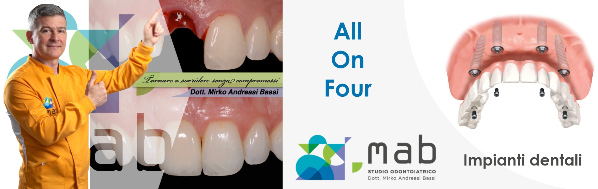 implantologia all on six studio dentistico dr mirko andreasi bassi